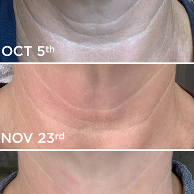 Neck Cream-Tighten & LiftFirming