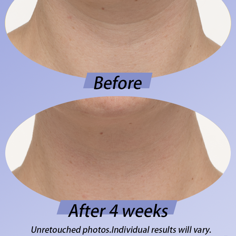 Neck Cream-Tighten & LiftFirming
