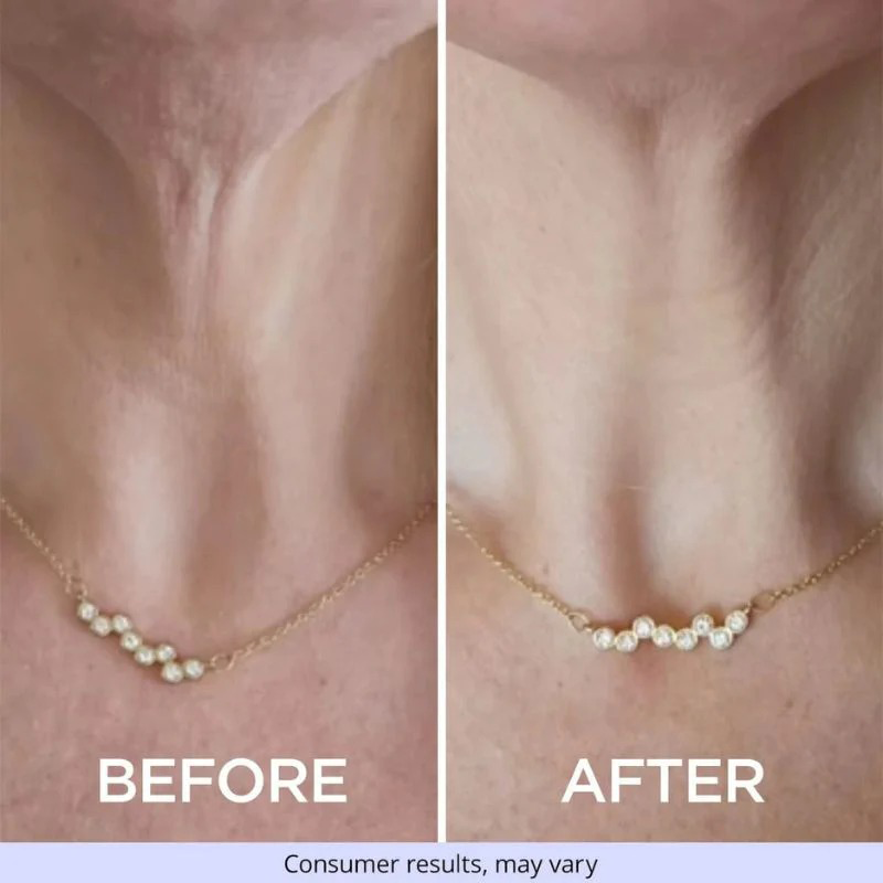 Neck Cream-Tighten & LiftFirming