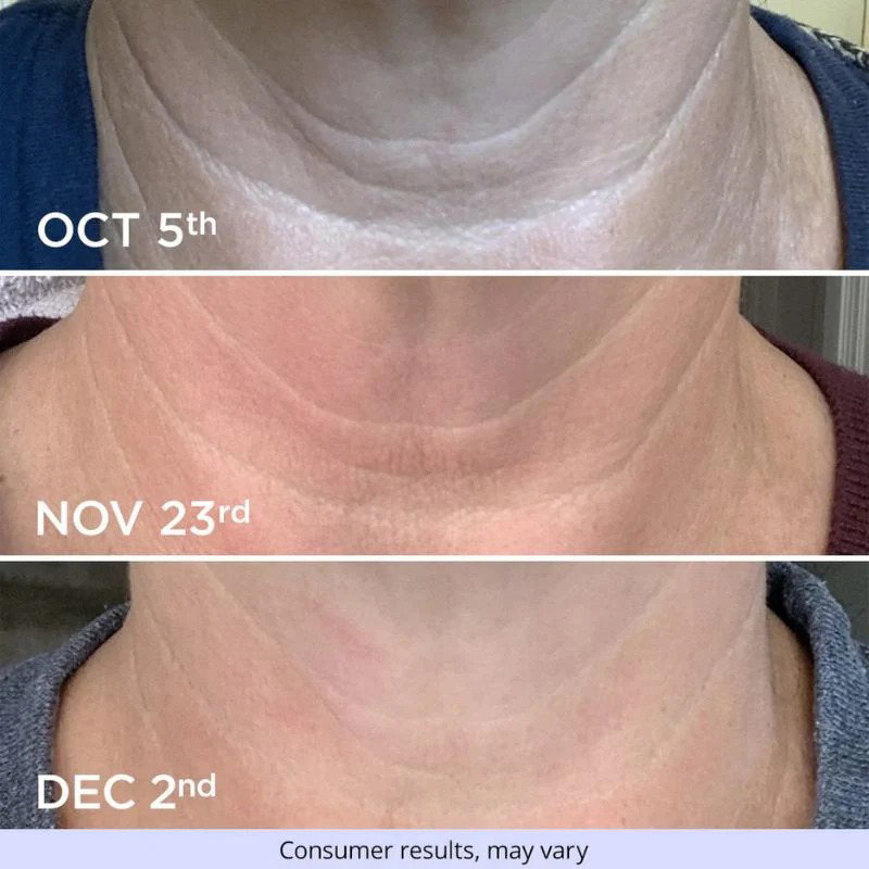 Neck Cream-Tighten & LiftFirming