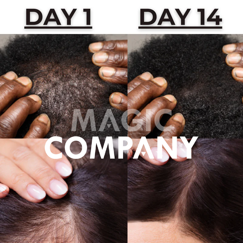 Hair Growth Scalp Ampoule