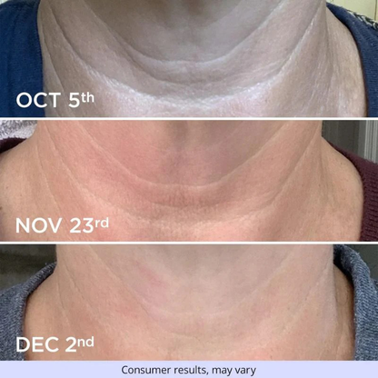 Neck Cream-Tighten & LiftFirming